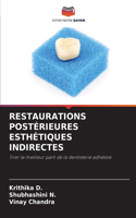 Restaurations Postérieures Esthétiques Indirectes