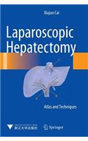 Laparoscopic Hepatectomy