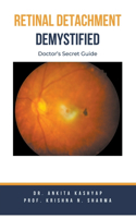 Retinal Detachment Demystified