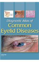 Diagnostic Atlas of Common Eyelid Diseases