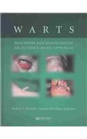 Warts