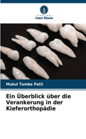 Überblick über die Verankerung in der Kieferorthopädie