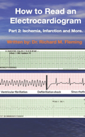 How to Read an Electrocardiogram