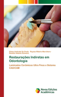 Restaurações Indiretas em Odontologia