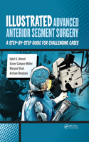 Illustrated Advanced Anterior Segment Surgery
