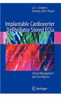 Implantable Cardioverter Defibrillator Stored Ecgs