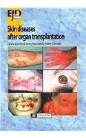 Skin Diseases After Organ Transplantation