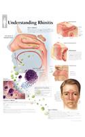 Understanding Rhinitis Paper Poster