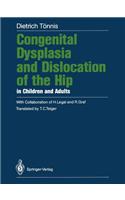 Congenital Dysplasia and Dislocation of the Hip in Children and Adults