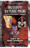 Angiography and Plaque Imaging