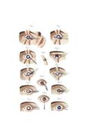 Cataract and Artificial Pupil Composition Notebook
