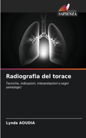 Radiografia del torace