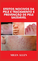 Efeitos Nocivos Da Pele E Tratamento E Prevenção de Pele Saudável