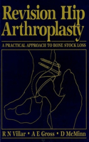 Revision Hip Arthroplasty: A Practical Approach to Bone Stock Loss