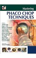 Mastering Phaco Chop Techniques