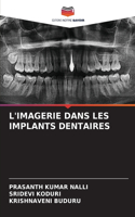 L'Imagerie Dans Les Implants Dentaires