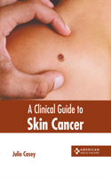 Clinical Guide to Skin Cancer