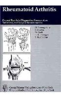 Rheumatoid Arthritis