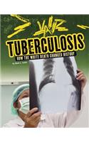 Tuberculosis