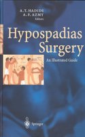 Hypospadias Surgery: An Illustrated Guide