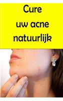 Cure uw acne natuurlijk