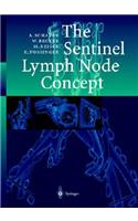 Sentinel Lymph Node Concept