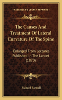 Causes and Treatment of Lateral Curvature of the Spine
