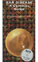 CLINICAL POCKET GUIDE TO EAR DISEASE