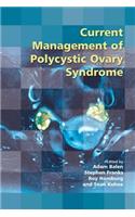 Current Management of Polycystic Ovary Syndrome