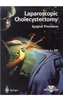 Laparoscopic Cholecystectomy - Surgical Procedure