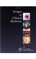 Images in Clinical Medicine: Selections from the New England Journal of Medicine