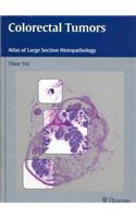 Colorectal Tumors