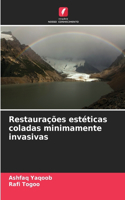 Restaurações estéticas coladas minimamente invasivas