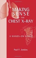 Making Sense of the Chest X-Ray: A Hands-On Guide