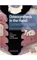 Osteosynthesis in the Hand: Current Concepts
