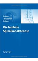 Die Lumbale Spinalkanalstenose