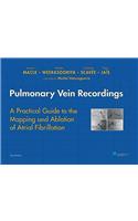 Pulmonary Vein Recordings