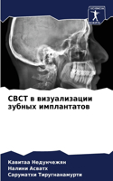 Cbct в визуализации зубных имплантатов