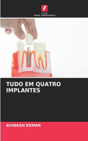 Tudo Em Quatro Implantes