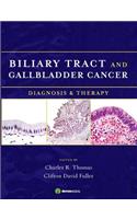 Biliary Tract and Gallbladder Cancer