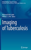 Imaging of Tuberculosis