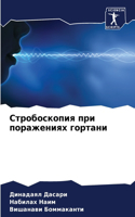 Стробоскопия при поражениях гортани