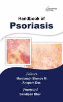 Handbook of Psoriasis