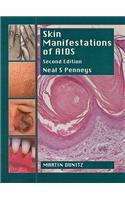 Skin Manifestations of Aids