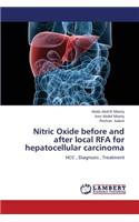 Nitric Oxide Before and After Local Rfa for Hepatocellular Carcinoma