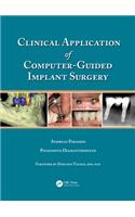 Clinical Application of Computer-Guided Implant Surgery