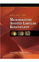 Atlas of Microkeratome Assisted Lamellar Keratoplasty