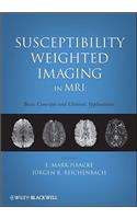 Susceptibility Weighted Imaging in MRI