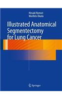 Illustrated Anatomical Segmentectomy for Lung Cancer