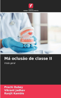 Má oclusão de classe II
